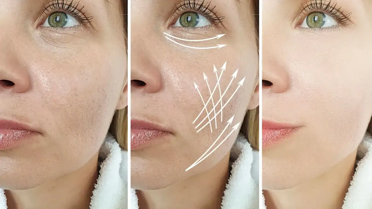 Can One Treatment Really Tackle More Than One Skin Concern Gainsborough?