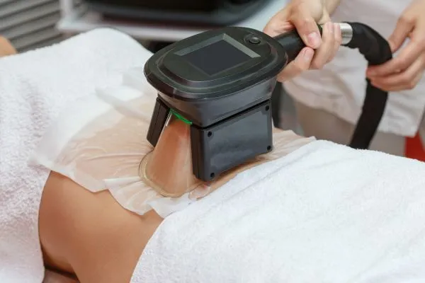 Image of person having fat freezing treatment to help weight gain Gainsborough