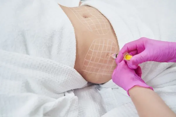 image of fat dissolving injections on love handles to help combat weight gain Gainsborough