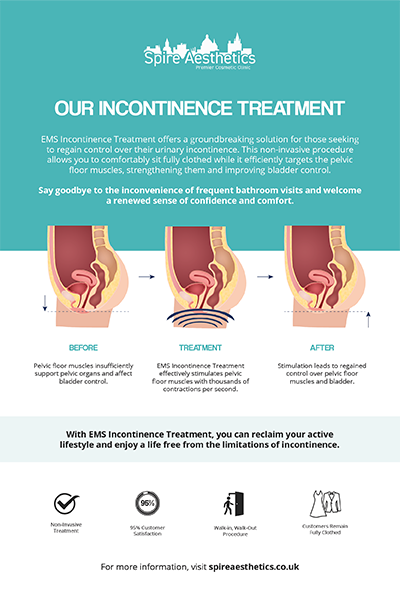 image to show how EMS treatment works for female urinary incontinence Gainsborough