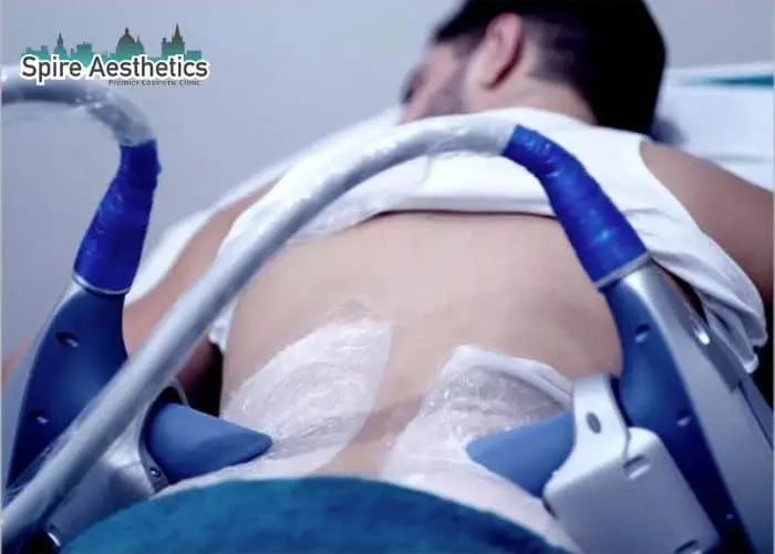 Man having fat freezing treatment done on love handles before a competitions Gainsborough to create a sculpted look.