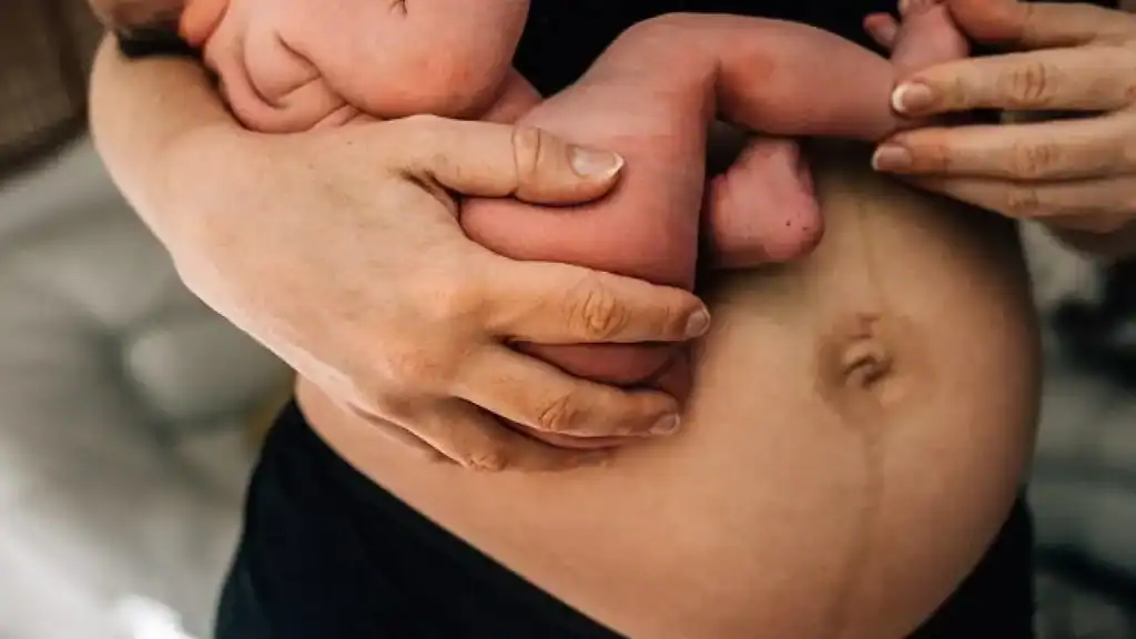Why Is My Stomach Still Big After Pregnancy Gainsborough?