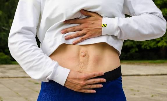 When Could Diastasis Recti Be the Missing Piece of the Puzzle Gainsborough?